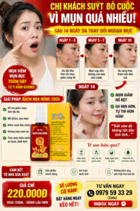 Hành trình trị mụn của chị khách 32 tuổi: Từ tuyệt vọng đến tự tin